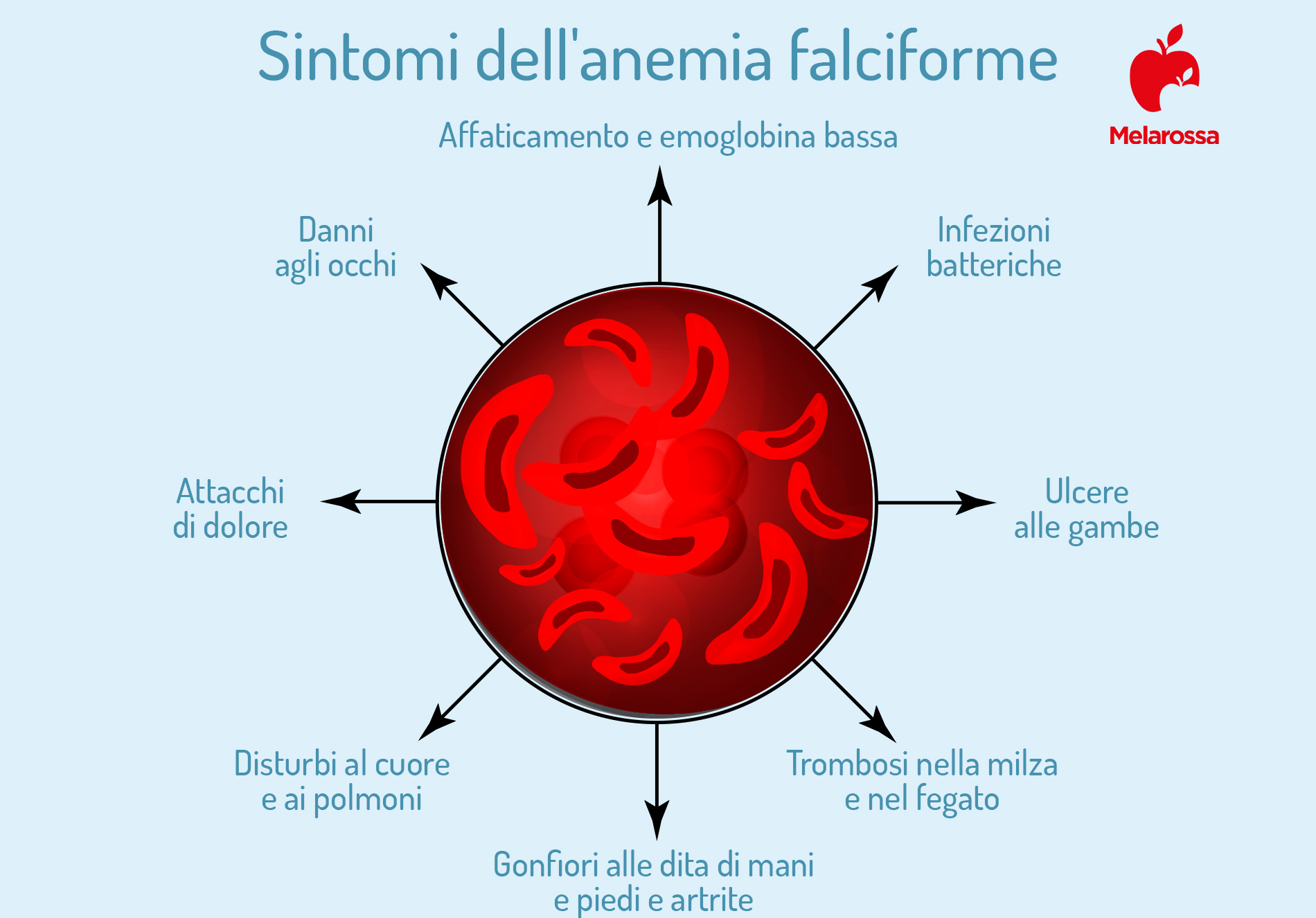 anemia falciforme sintomi