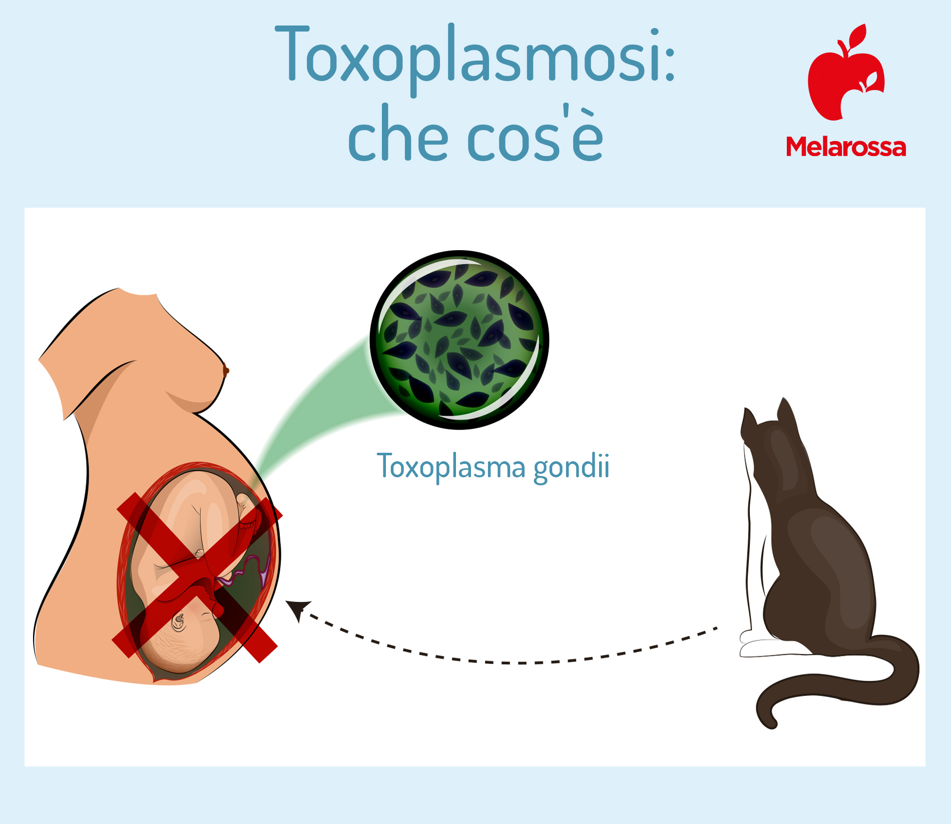 toxoplasmosi: che cos'è