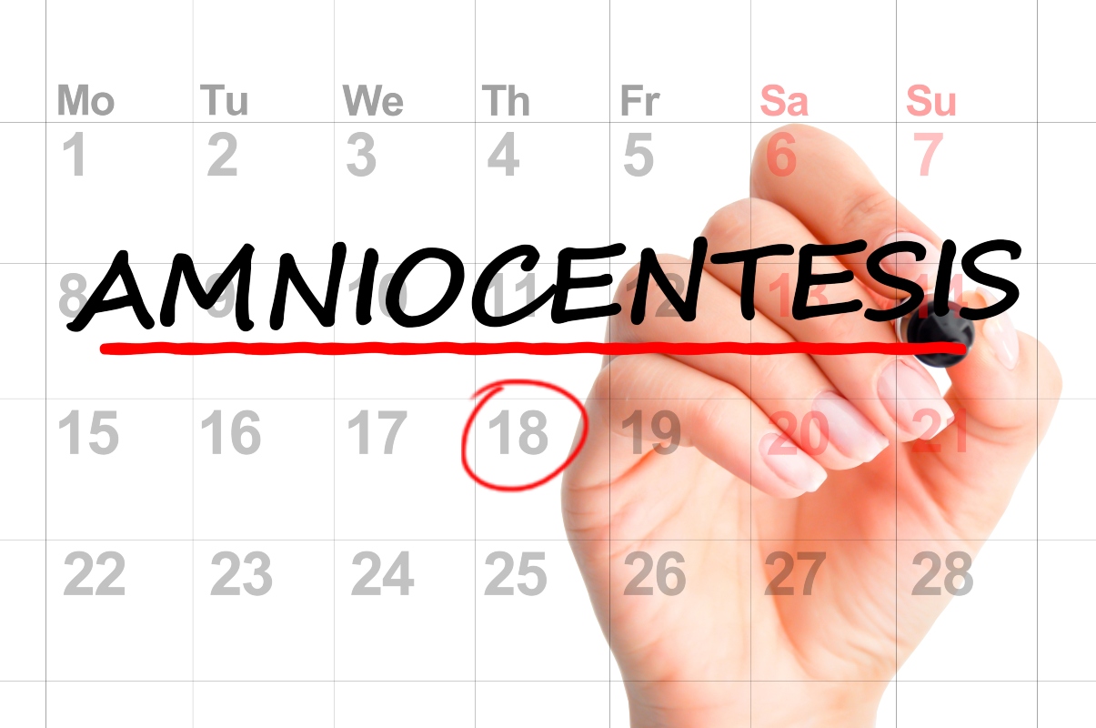 amniocentesi: quando farla