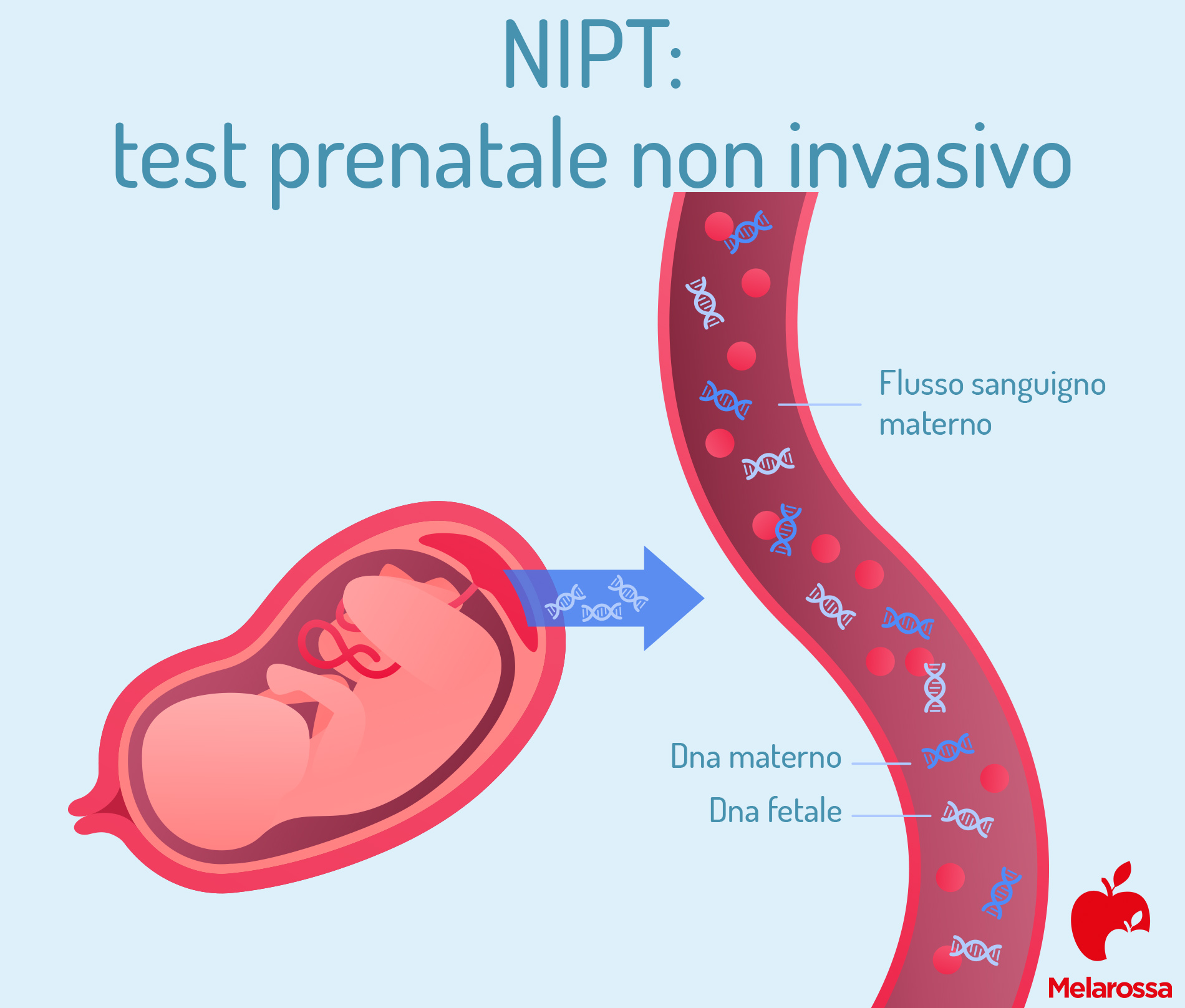 amniocentesi o test prenatale non invasivo