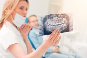 Denti del giudizio: quali sono, sintomi e complicanze, quando toglierli e come alleviare il dolore