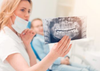 Denti del giudizio: cosa sono, sintomi, complicanze, quando toglierli