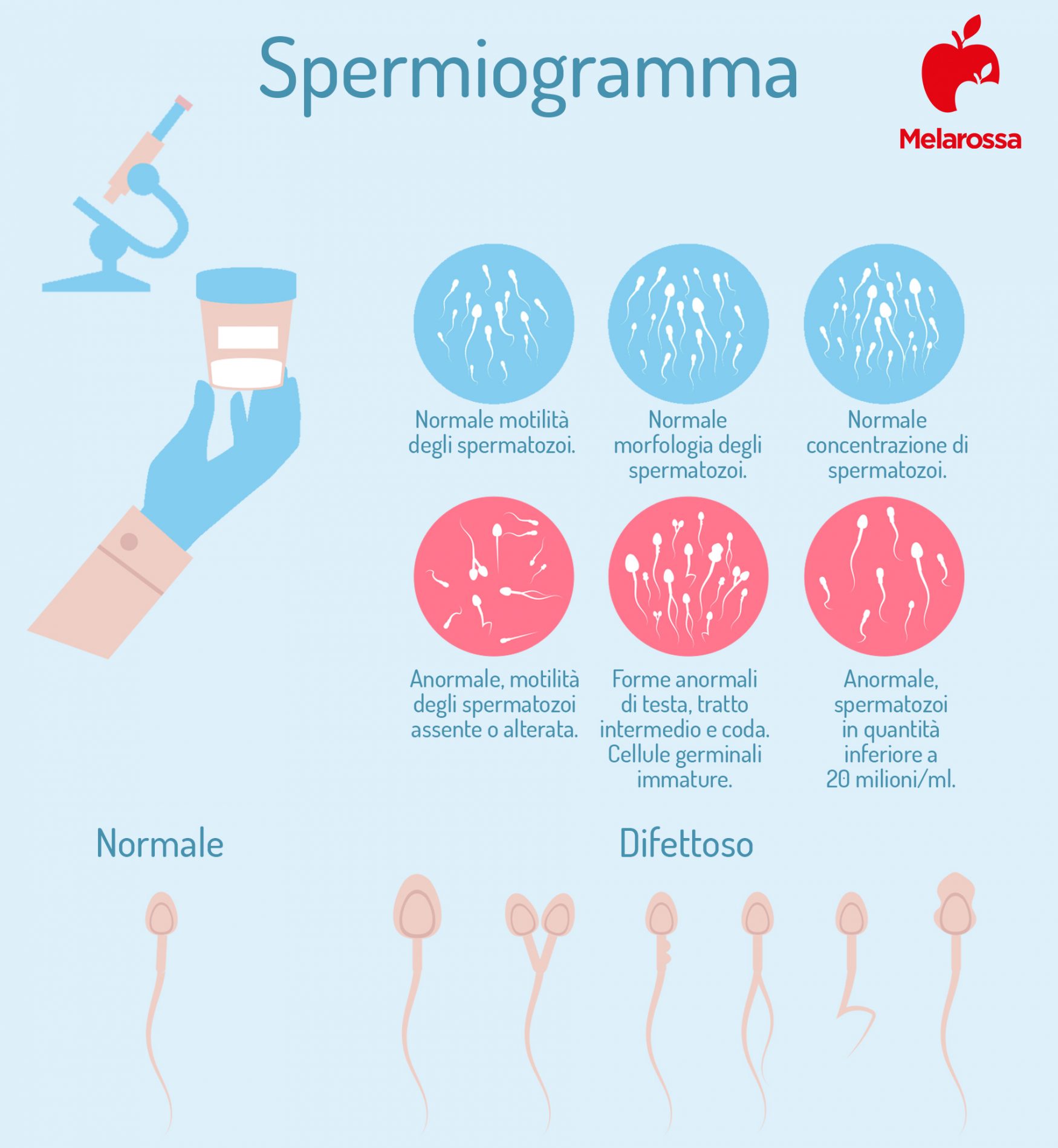 spermiogramma: che cos'è