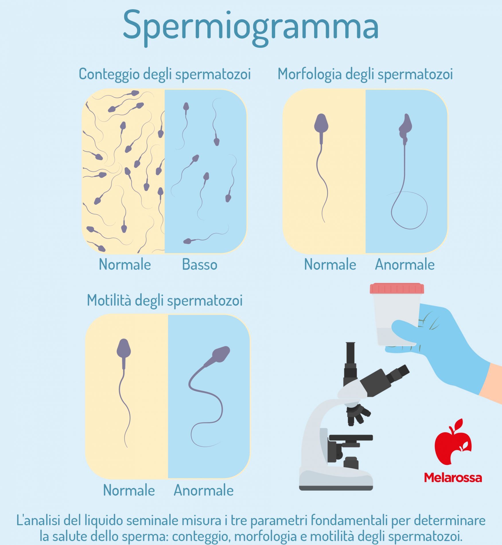 spermiogramma: analisi