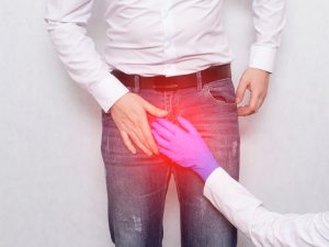 Varicocele: cos’è, cause, sintomi, diagnosi e cura