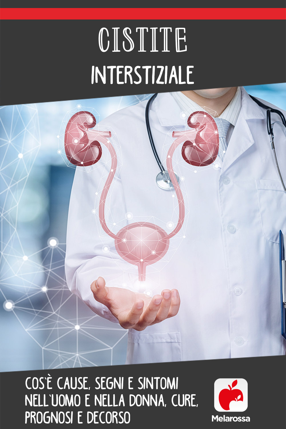 cistite intersiziale