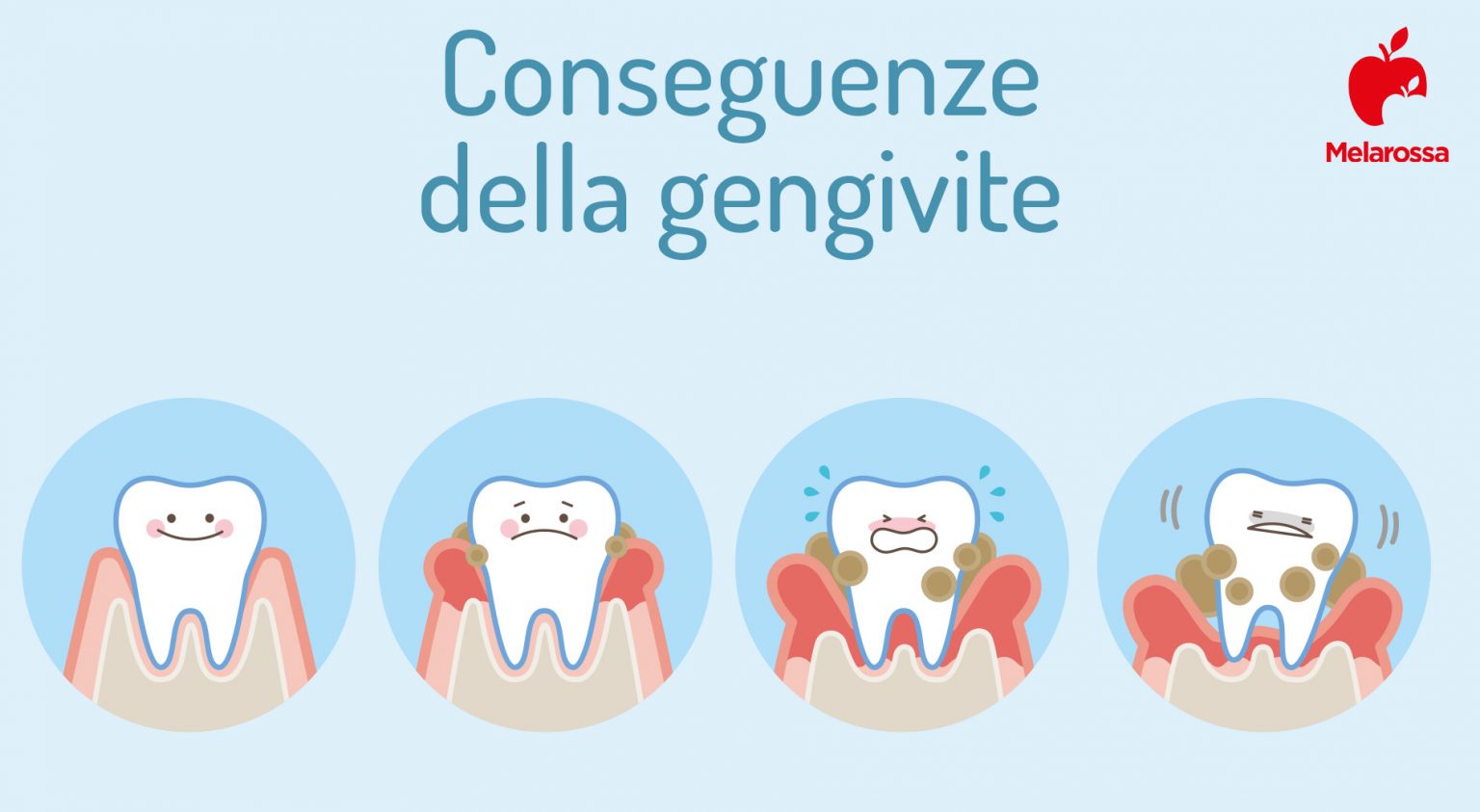 denti: conseguenze della gengivite
