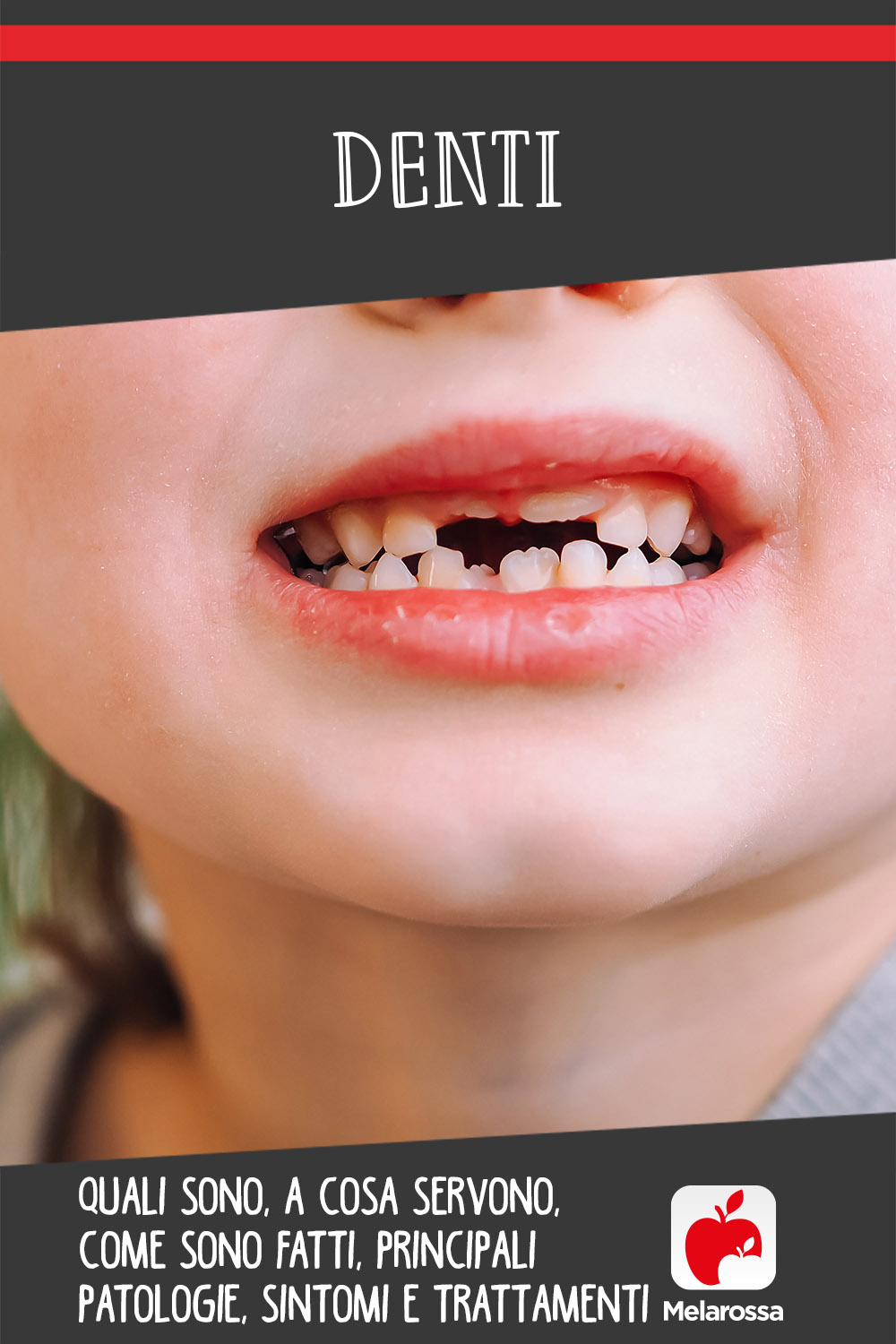 denti: anatomia, patologia e cure