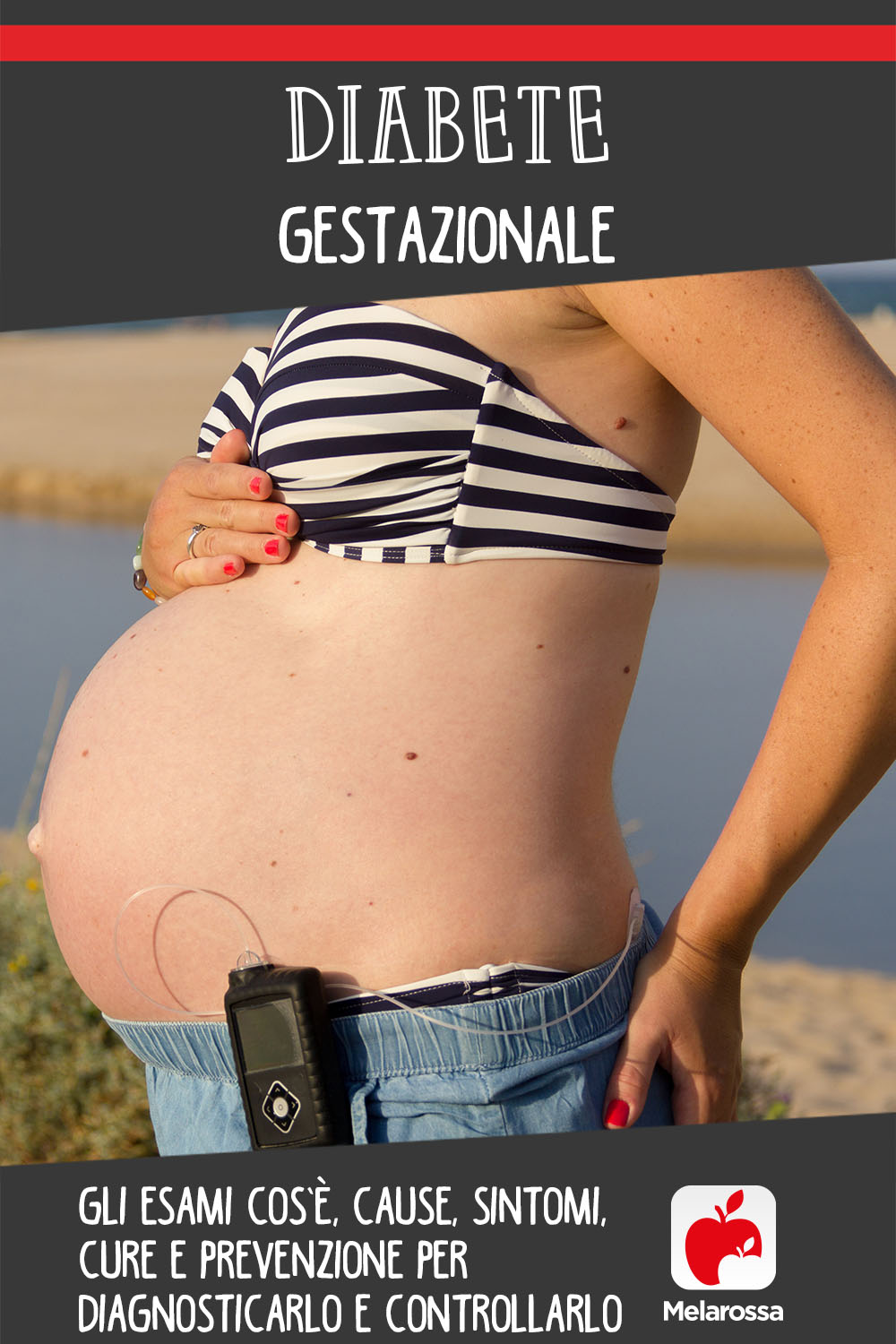 diabete gestazionale