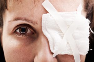 Diplopia monoculare e binoculare: che cos’è, cause, tipi, sintomi, diagnosi e cure