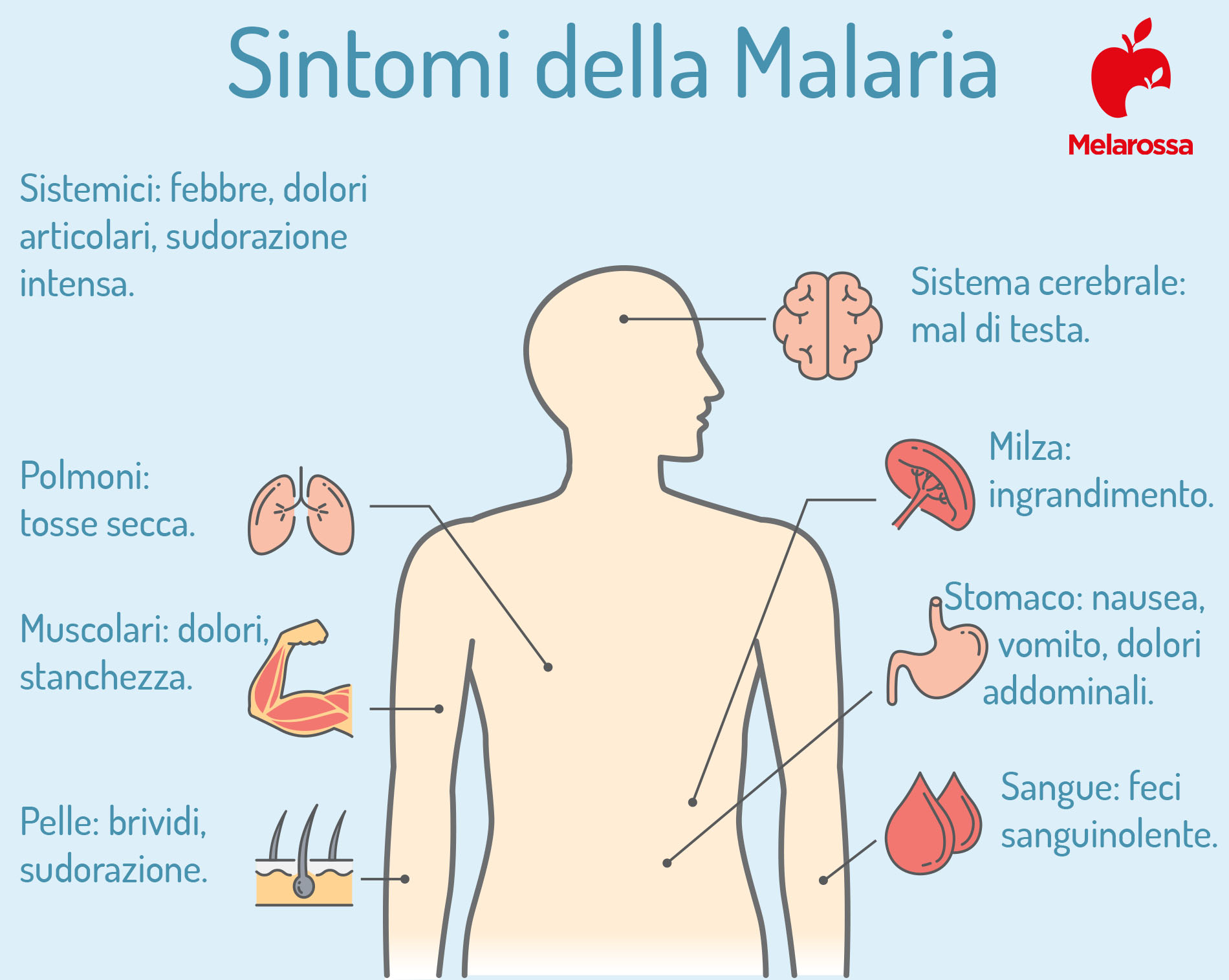 malaria: sintomi