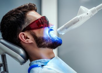 sbiancamento denti: cos'è, come funziona, tipologia, risultati, effetti collaterali