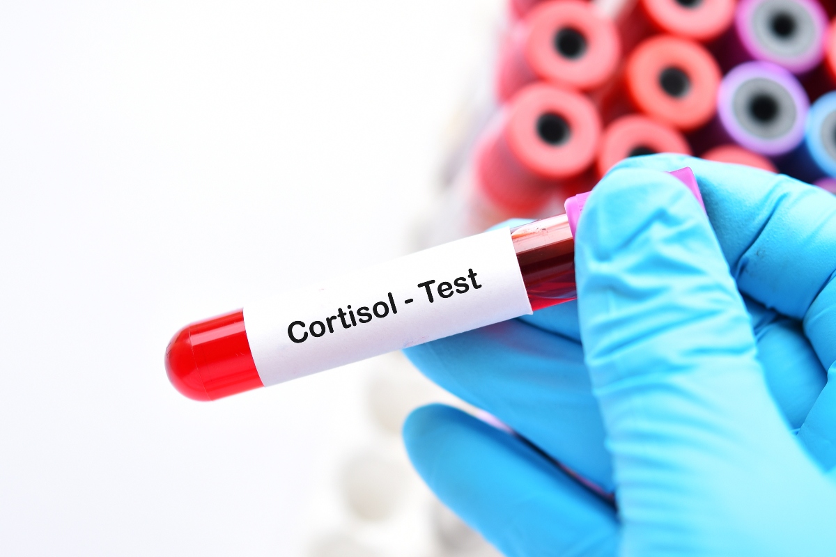 test del cortisolo 