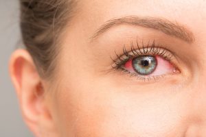 Uveite all’occhio: cos’è,  quanti tipi esistono, cause, sintomi, diagnosi e cure