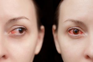 Distacco della retina: che cos’è, tipologie, sintomi, cause, diagnosi e cure possibili