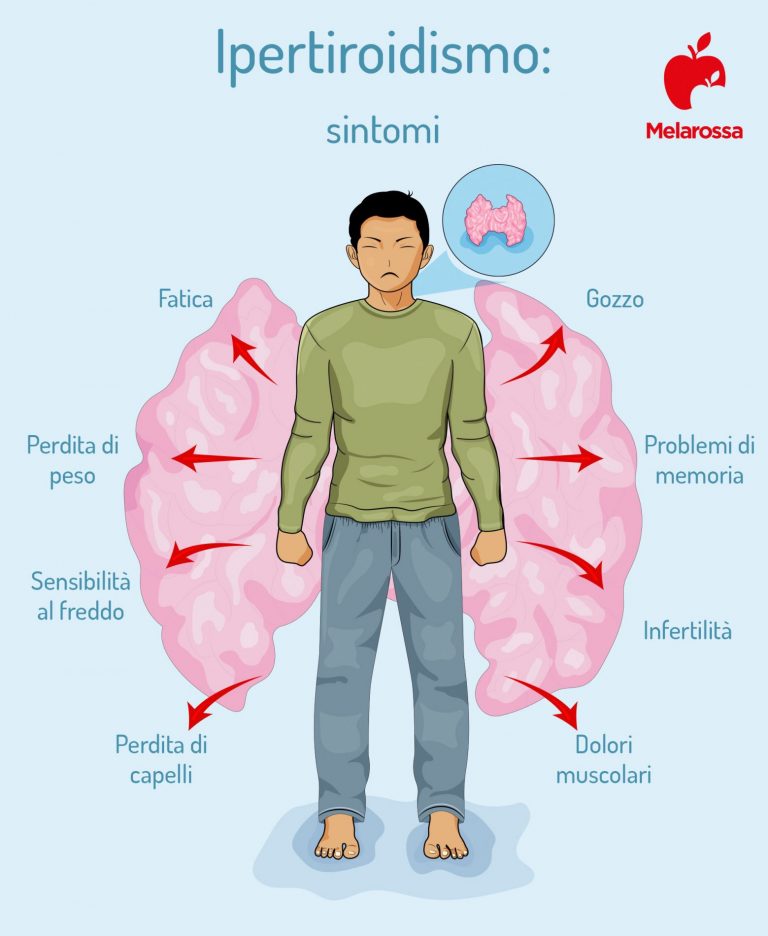 Tiroidite di Hashimoto che cos’è, sintomi, diagnosi e cure Tiroidite di Hashimoto che cos’è, sintomi, diagnosi e cure