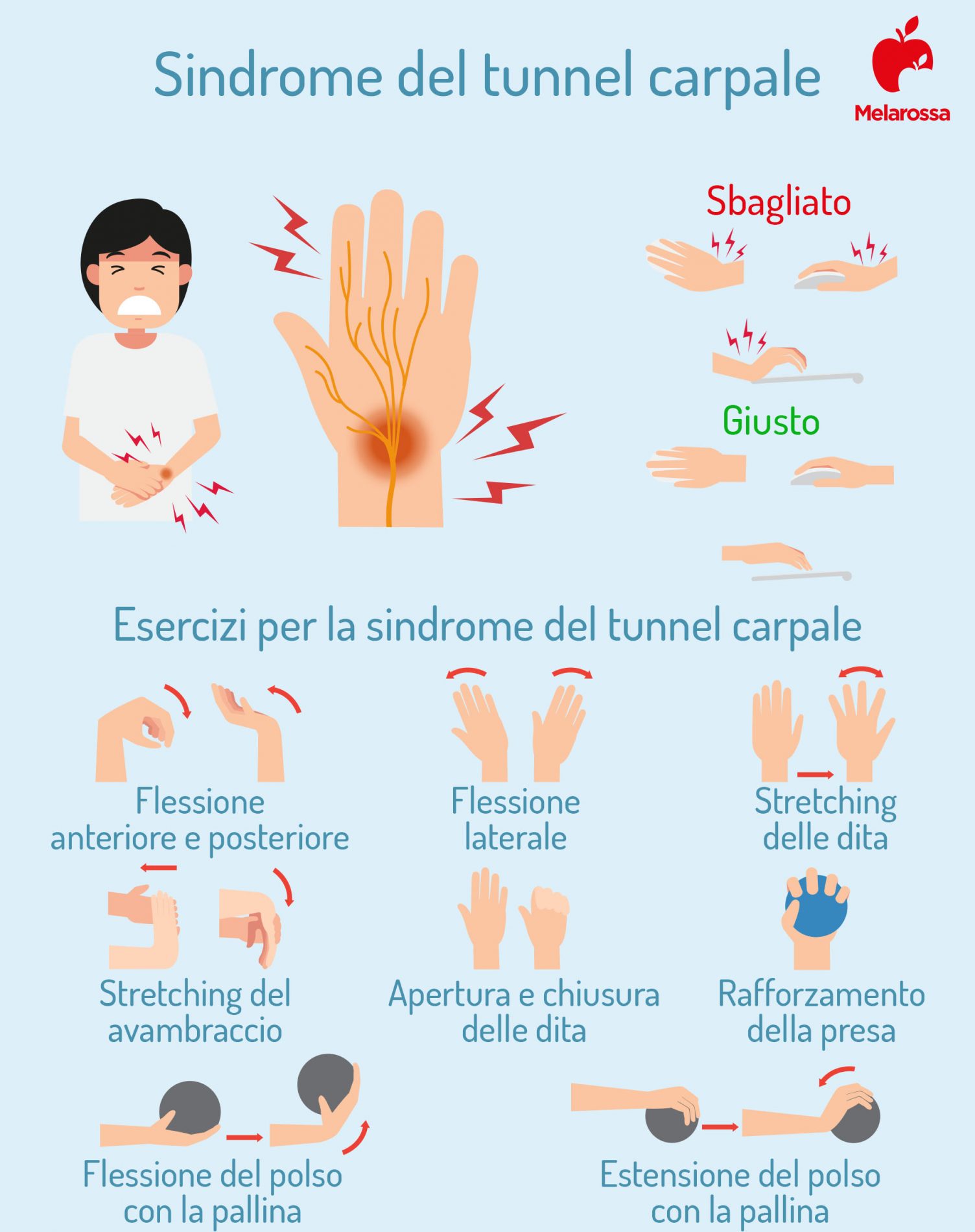 sindrome del tunnel carpale: esercizi per ridurre il dolore