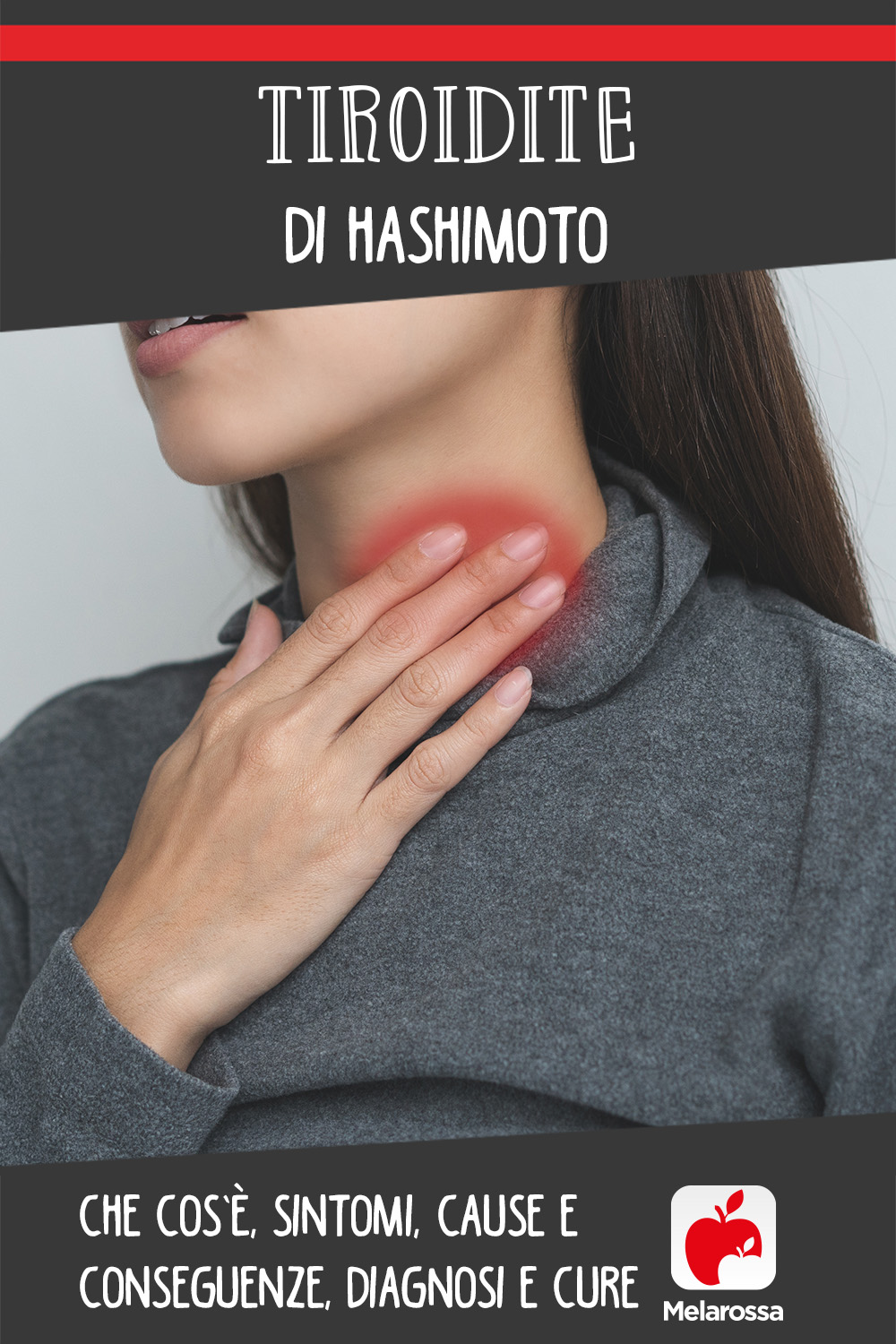 tiroidite di hashimoto: cos'è, cause, sintomi e cure