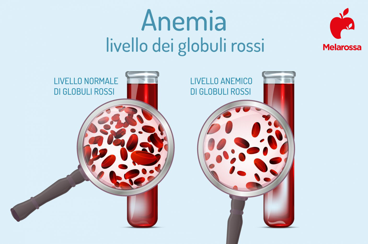 eritrociti valori bassi: anemia 