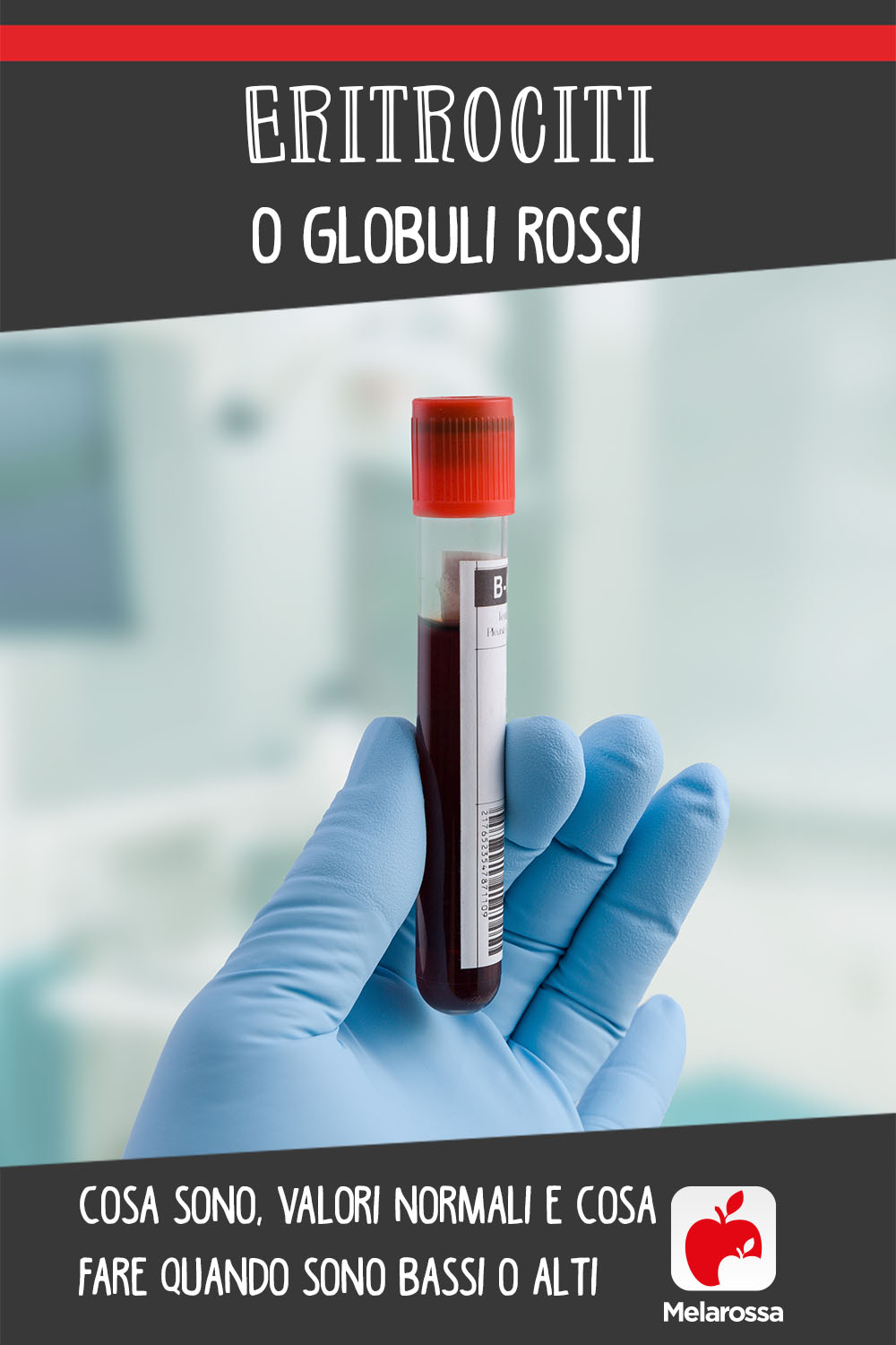 eritrociti o globuli rossi: cosa sono, valori normali e cosa fare quando ci sono valori alti e bassi 