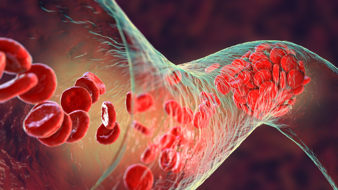 eritrociti o globuli rossi: cosa sono e a cosa servono 