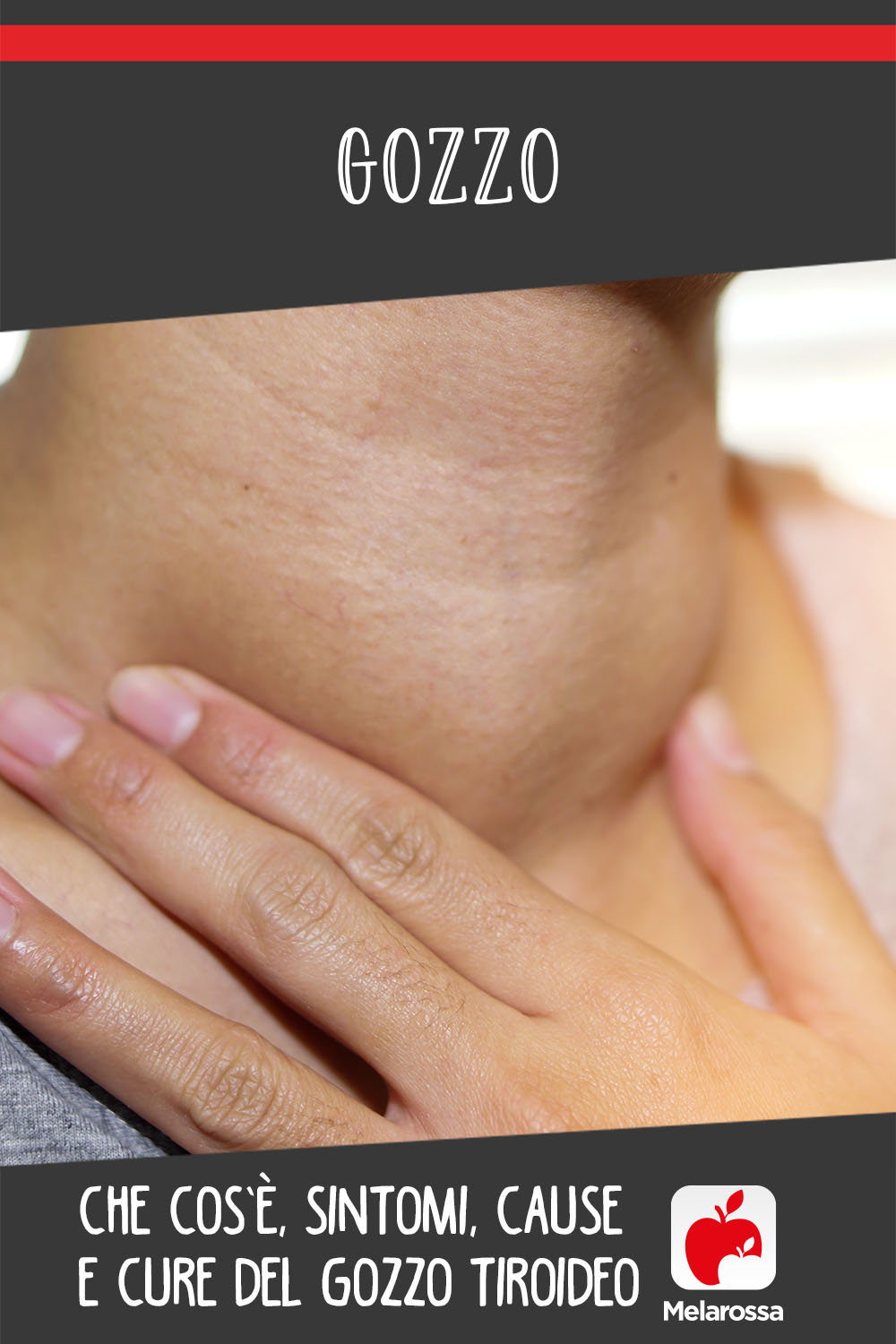 gozzo tiroideo: cos'è, sintomi, cause e cure
