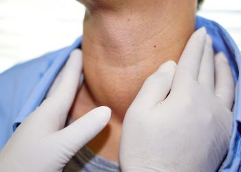 gozzo tiroideo: cos'è, cause, sintomi e cure