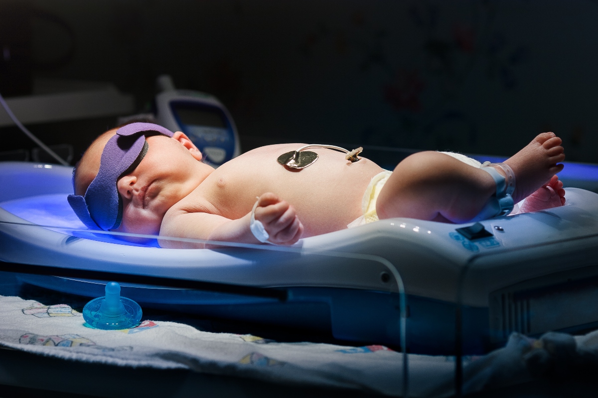 ittero neonatale 