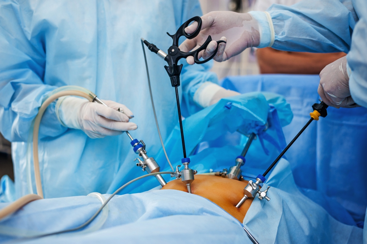 laparoscopia: come si esegue