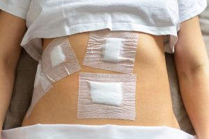 Laparoscopia: come funziona, vantaggi e possibili rischi