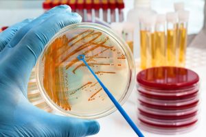 Urinocoltura: che cos’è, a cosa serve, l’importanza dell’antibiogramma, come leggere i risultati