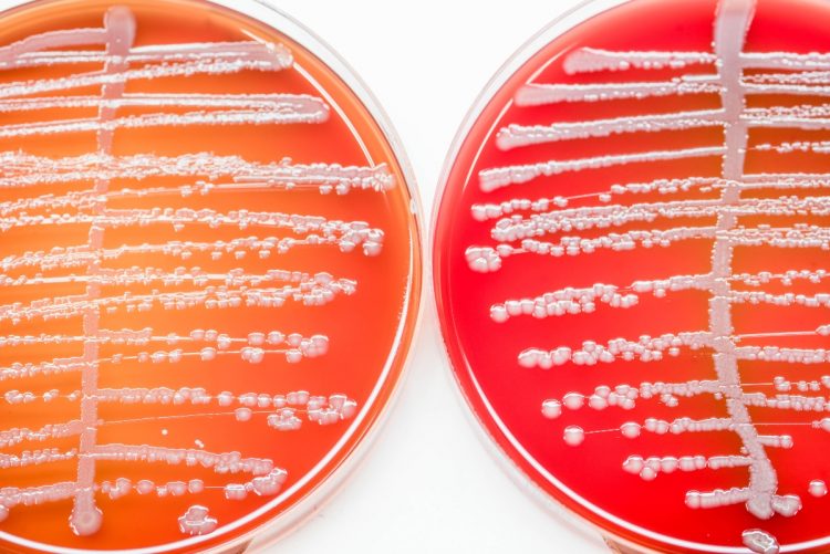 Urinocoltura che cos’è, a cosa serve, quando si esegue, risultati