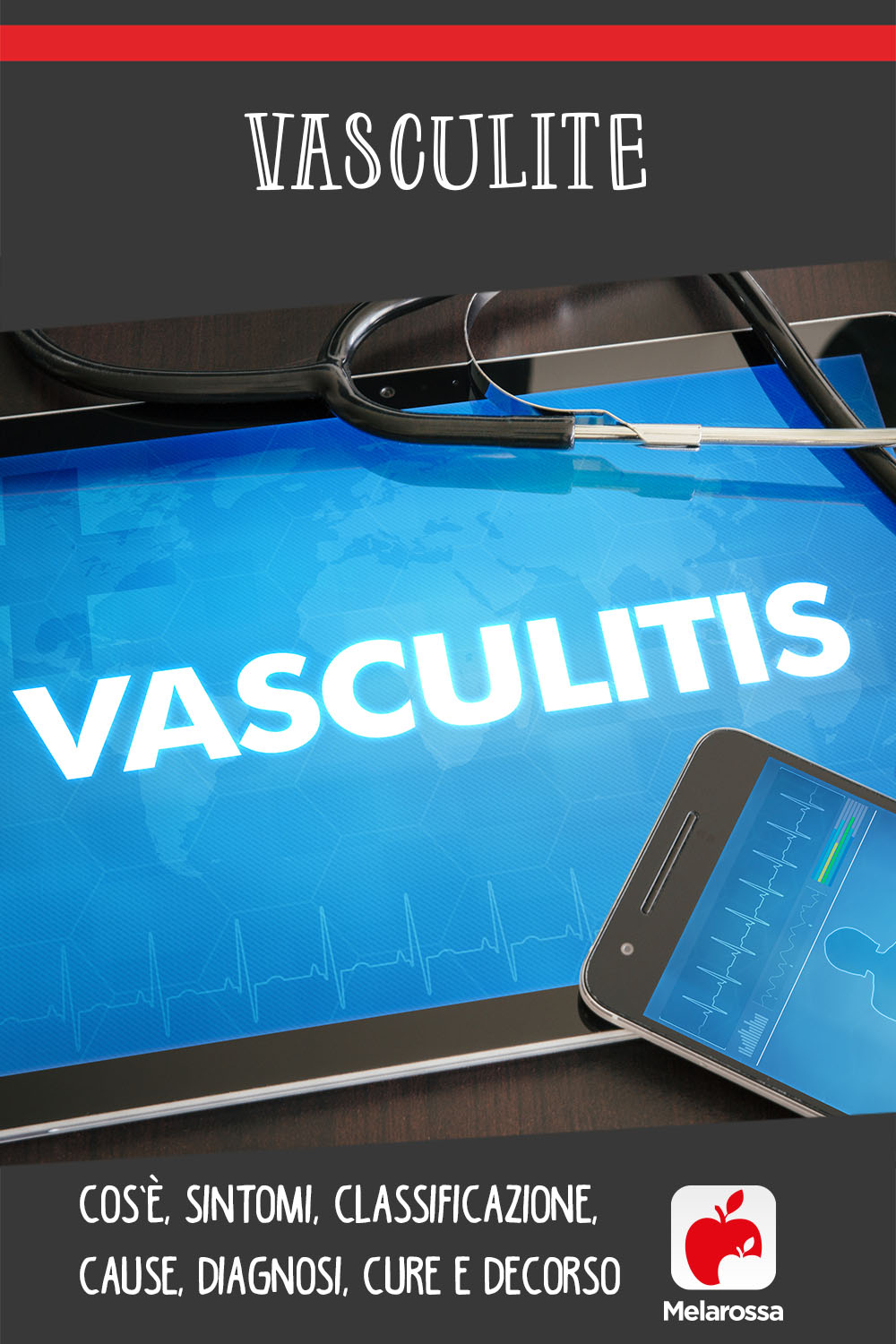 vasculite: cos'è, cause, sintomi e cure 
