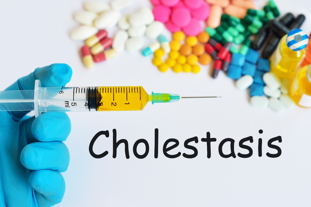 come curare la colestasi 