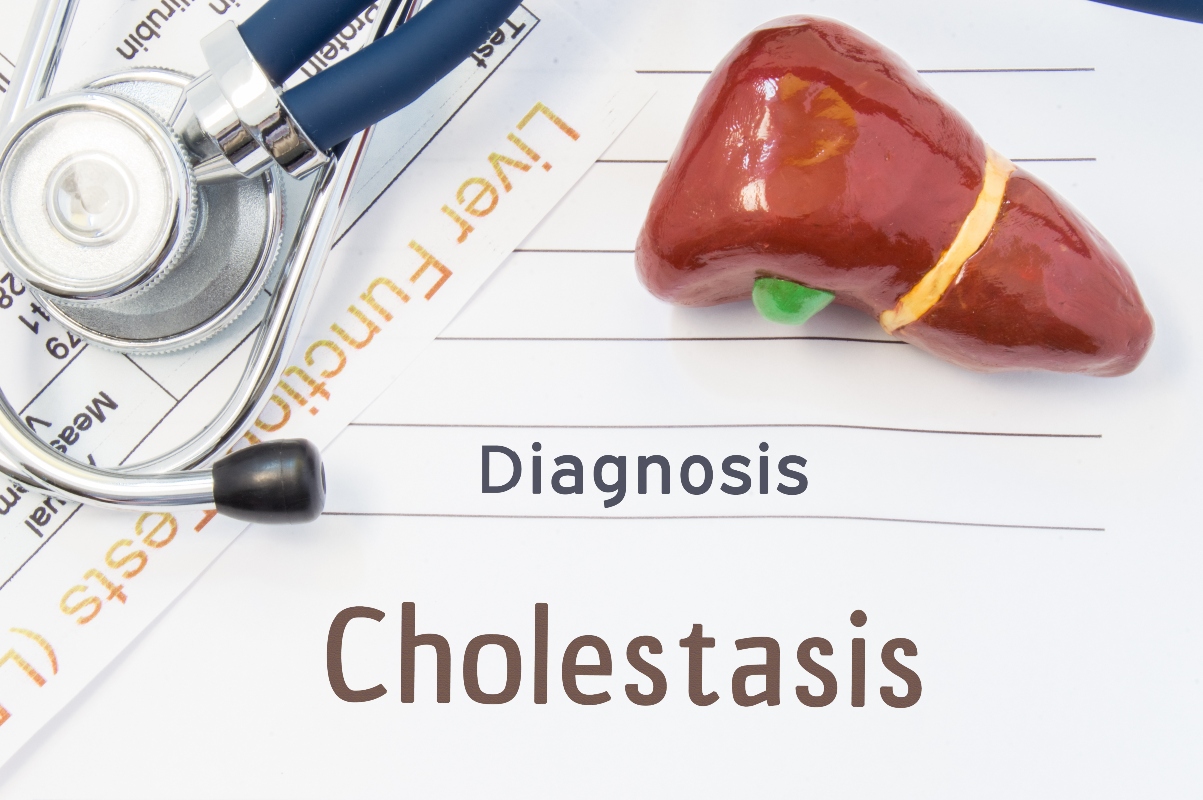 colestasi: diagnosi 
