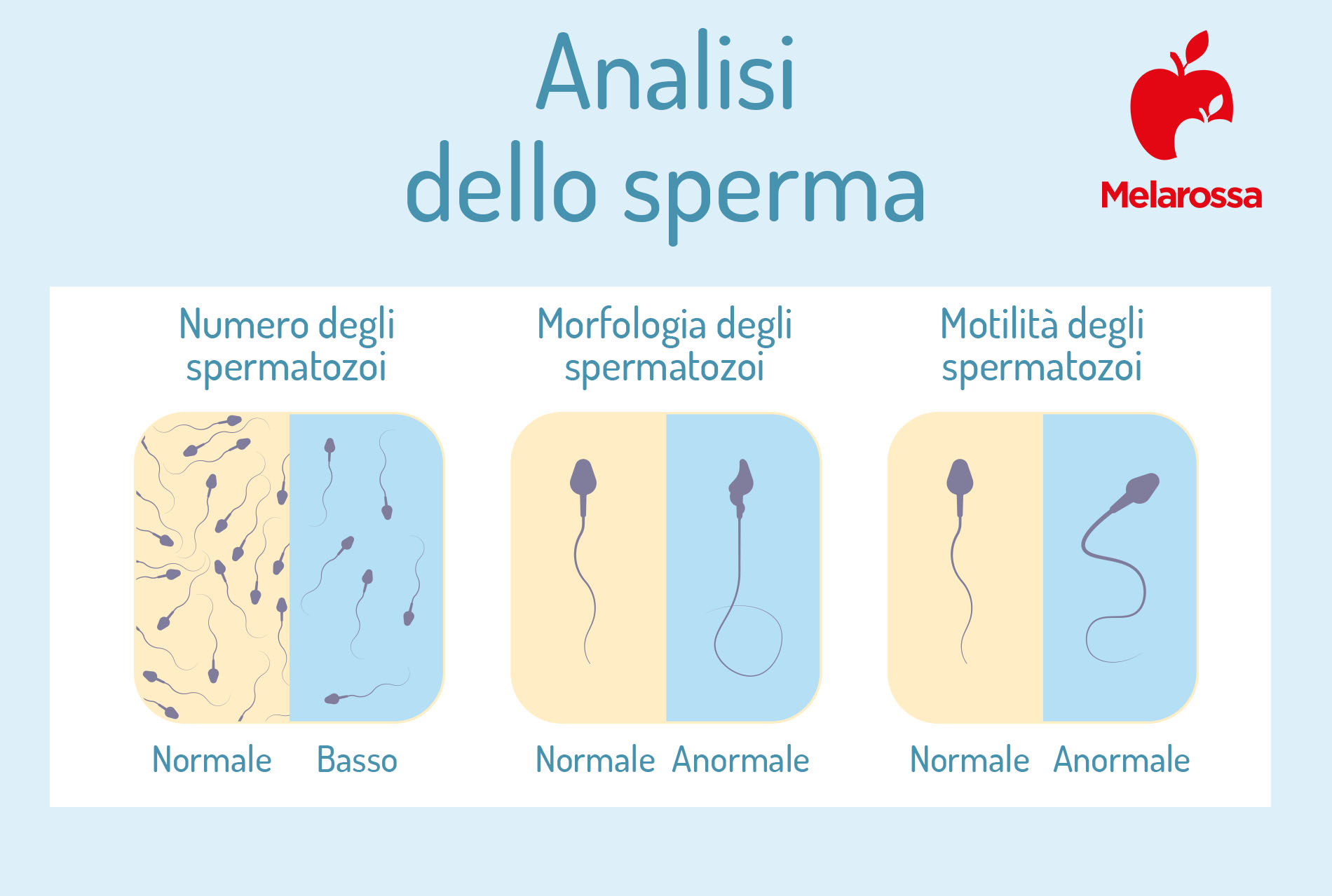 eiaculazione precoce: analisi dello sperma 