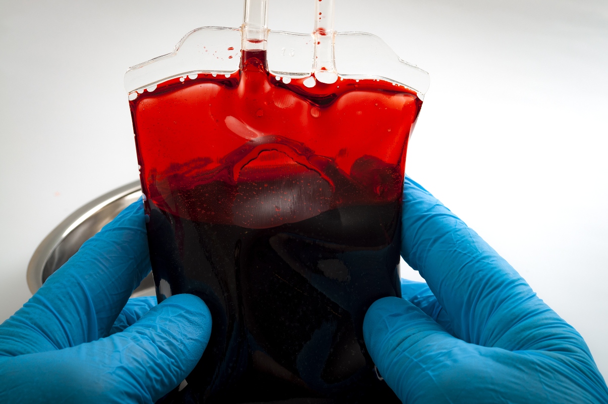 gruppi sanguigni e trasfusione del sangue 