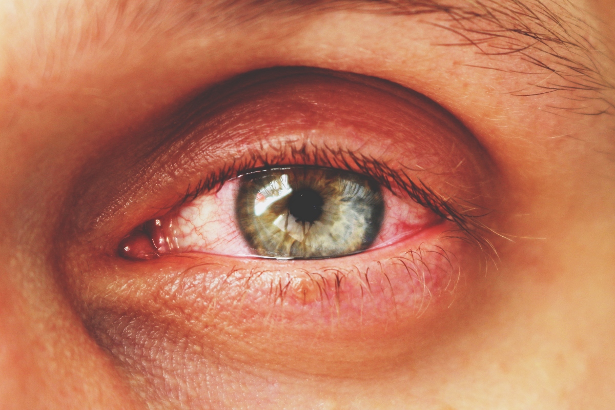 malattie dell'occhio. patologie e disturbi