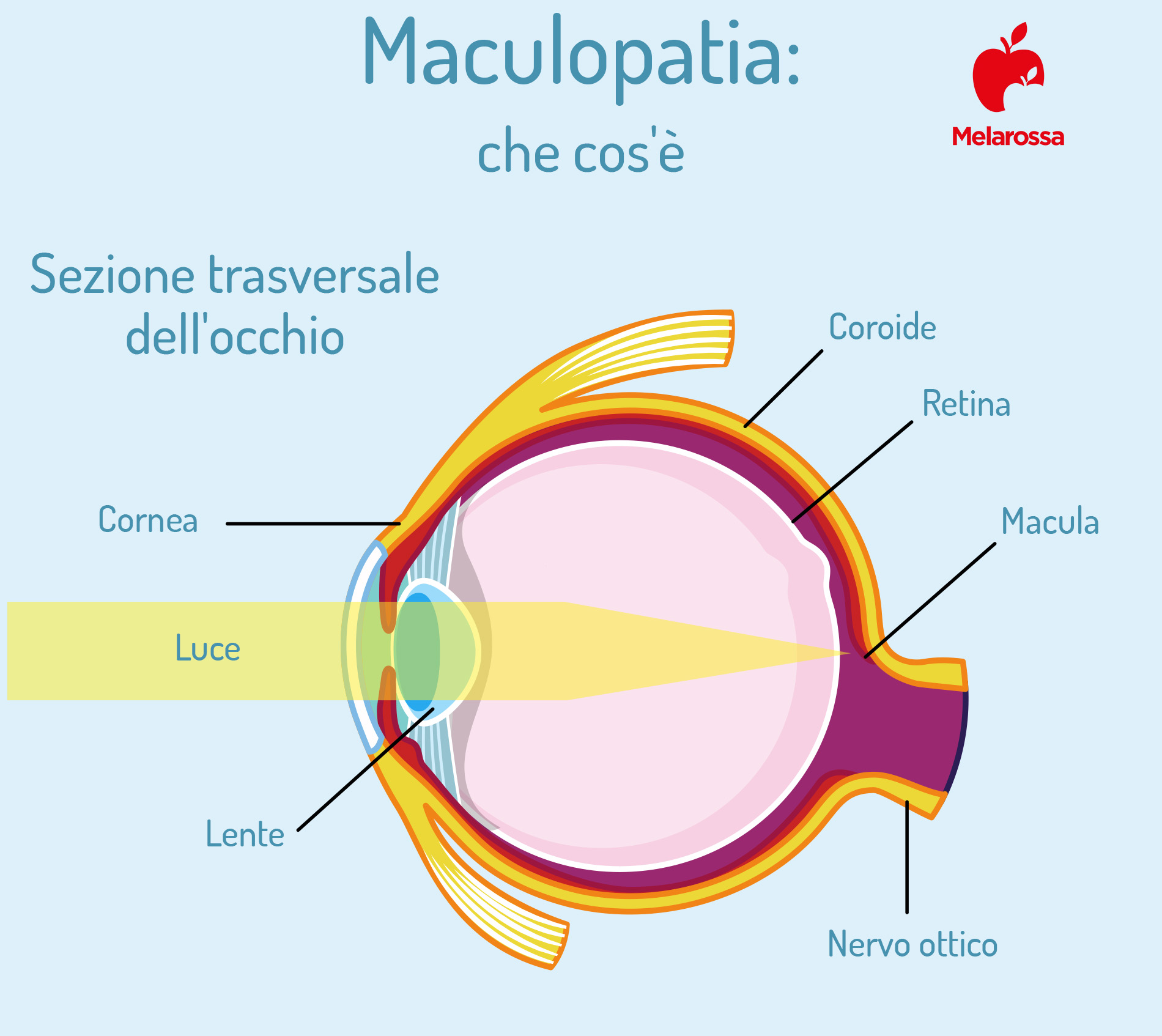 malattie dell'occhio: maculopatia 