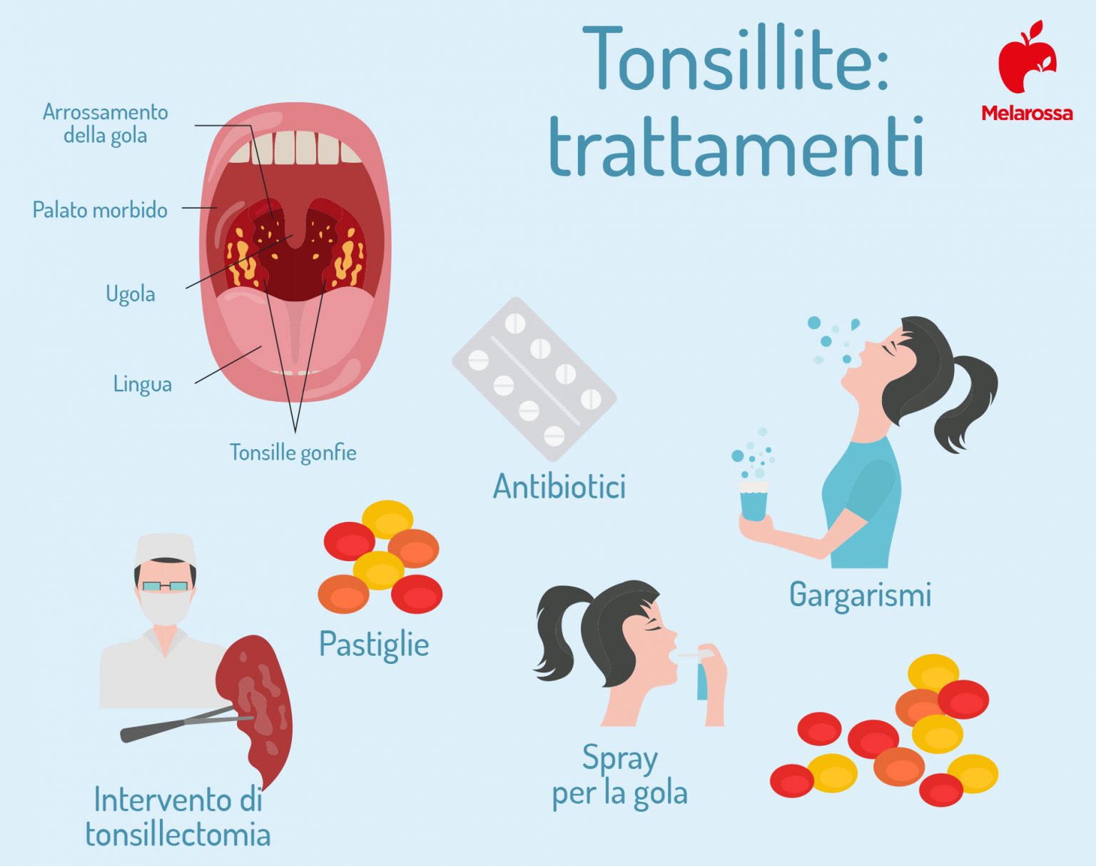 raffreddore e tonsilite 