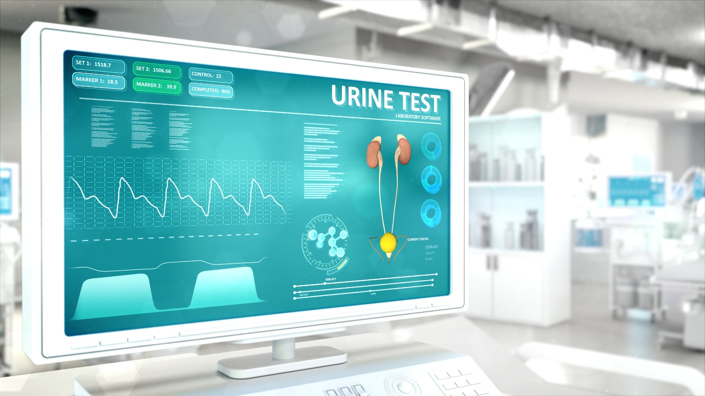 sangue nelle urine: che esami fare 