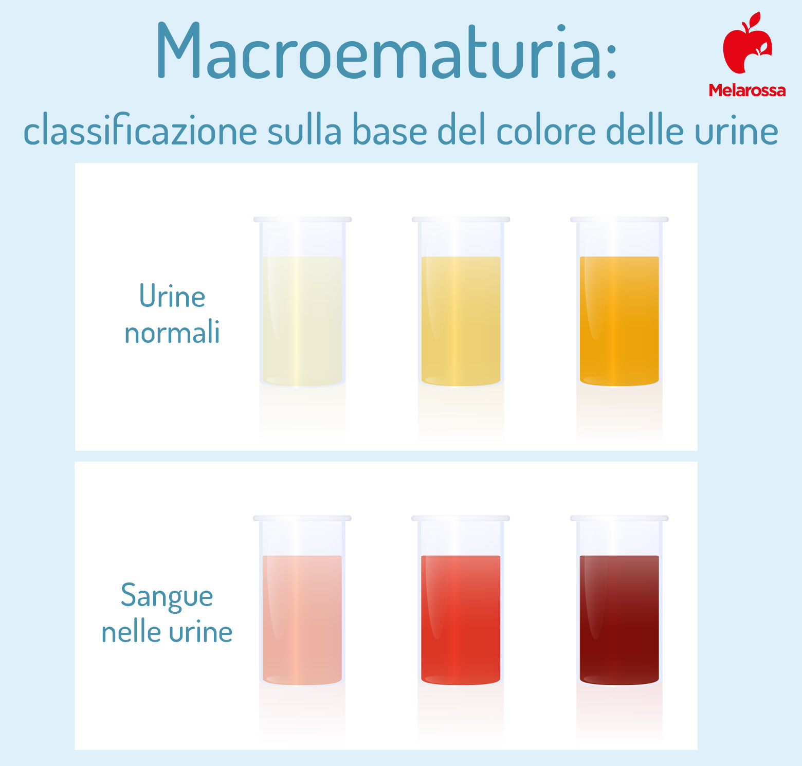 macroematuria: sangue nelle urine colore