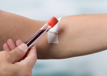 valori della glicemia: valori di riferimento, alti e bassiperché sono variabili, quando misurare la glicemia e come misurarla a casa