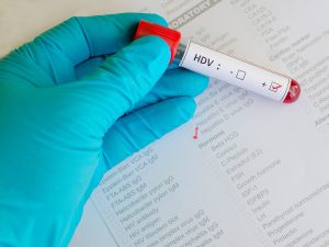 Epatite D: cos’è, sintomi, cause, come avviene il contagio, diagnosi, cure e prevenzione