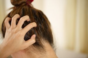Forfora secca e grassa: cos’è, cause, sintomi, come scegliere lo shampoo antiforfora e rimedi naturali per combatterla