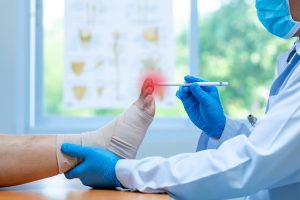 Osteofitosi: cos’è, cause, sintomi, tipi di osteofiti, diagnosi, cure e decorso