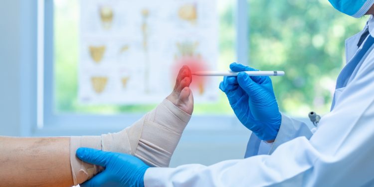 osteofitosi: che cos'è, cause. sintomi, diagnosi e cure