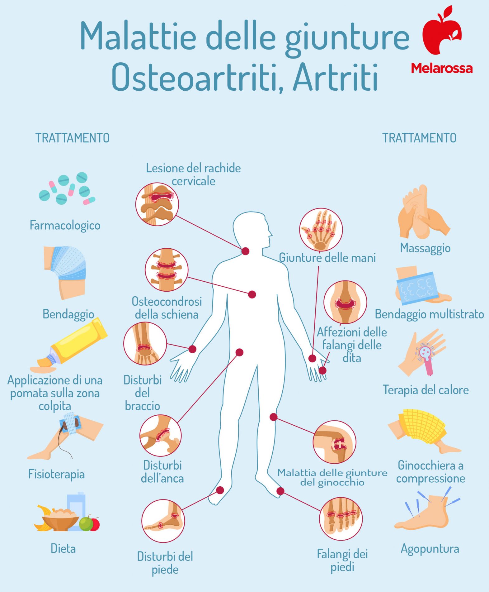 artrite: sintomi e cure