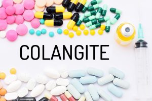 Colangite: cos’è, sintomi, cause, diagnosi e trattamento