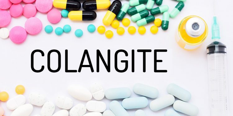 colangite: cos'è, cause, sintomi, diagnosi e cure